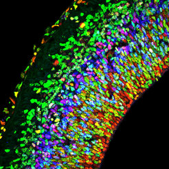 Tissue section through the embryonic cortex of a mouse:The various cell types are differently stained in the section. This enables a good view on the different cortical layers.