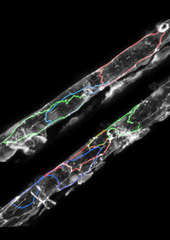 Genetic defect increases endothelial cellsBlood vessels of normal (top) and endoglin-deficient zebrafish (bottom) with individual endothelial cell outlines labelled. Abnormal cell organization leads to larger vessels in endoglin mutants.