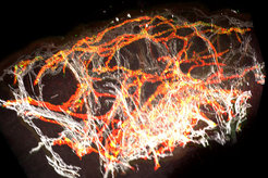3D computer reconstruction of a healthy human skin biobsy. Spatial arrangement of blood vessels (white) and lymphatic vessels (red) is distinctly visible.